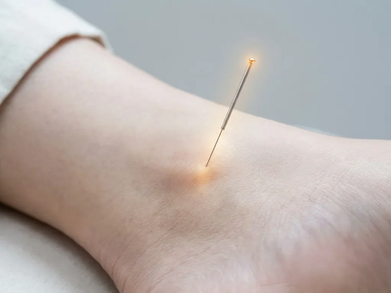 Akupunkturpunkt SP5: Geheimwaffe gegen Winter-Gelenkschmerzen? - Foto: über boerse-global.de