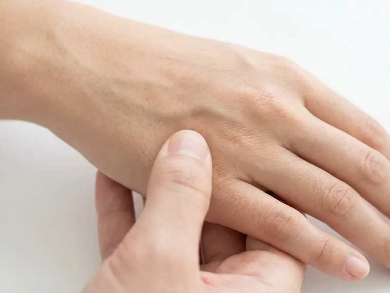 Akupressur-Punkt TE3: Geheimwaffe gegen den „Büro-Nacken“? - Foto: über boerse-global.de