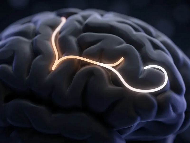 Neujahrsvorsätze trainieren das Gehirn - Foto: über boerse-global.de