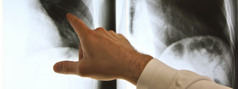 Patientenschützer sind über die geplanten Neuregelungen bei der Ärztewahl besorgt. (Archivbild) - Foto: Arno Burgi/dpa-Zentralbild/dpa