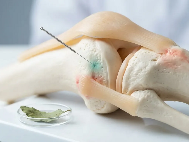 Akupunktur-Studie 2026: So bekämpft Elektroakupunktur Kniearthrose - Foto: über boerse-global.de