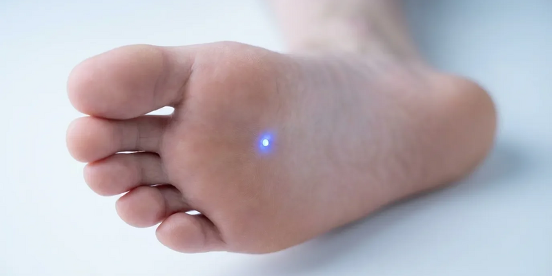 Akupunkturpunkt KI1: Neue Studien belegen Wirkung gegen Stress und Schlafstörungen - Foto: über boerse-global.de