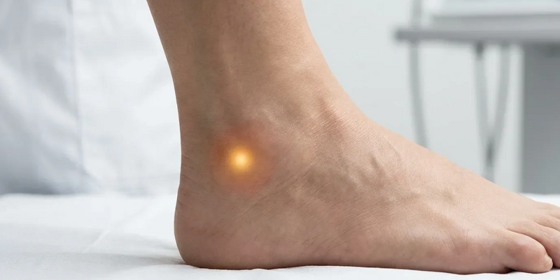 Akupunkturpunkt Blase 62: Altes Wissen gegen Wintersschmerz - Foto: über boerse-global.de