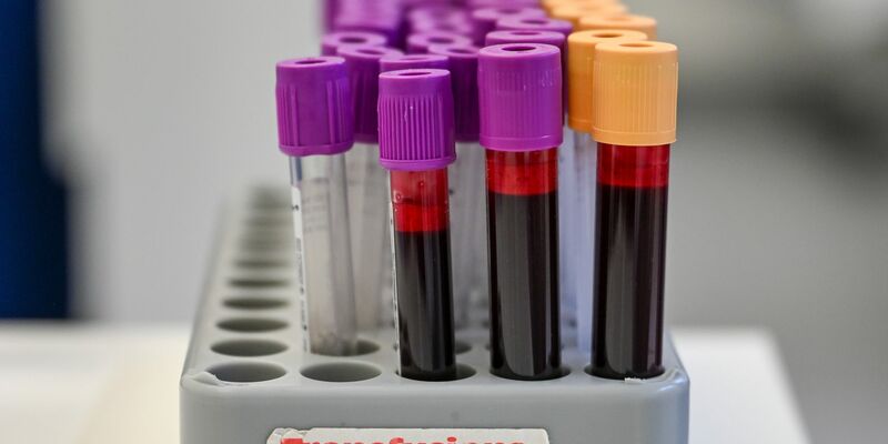 Eine Blutspende kann bis zu drei Menschen helfe (Symbolbild). - Foto: Jens Kalaene/dpa