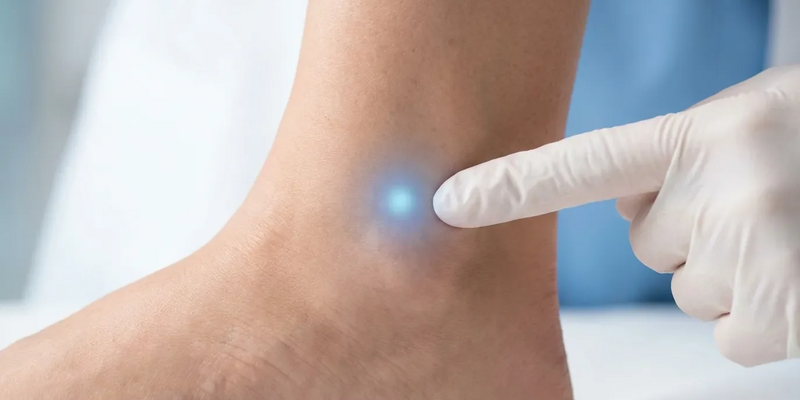 Akupunktur-Punkt Kidney 7: Neue Leitlinie setzt auf Akupressur gegen Winter-Ödeme - Foto: über boerse-global.de