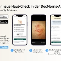 Autoderm ergänzt digitales Gesundheitsökosystem von DocMorris mit KI-Hautanalyse - Foto: presseportal.de