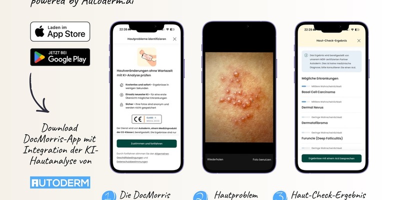 Autoderm ergänzt digitales Gesundheitsökosystem von DocMorris mit KI-Hautanalyse - Foto: presseportal.de