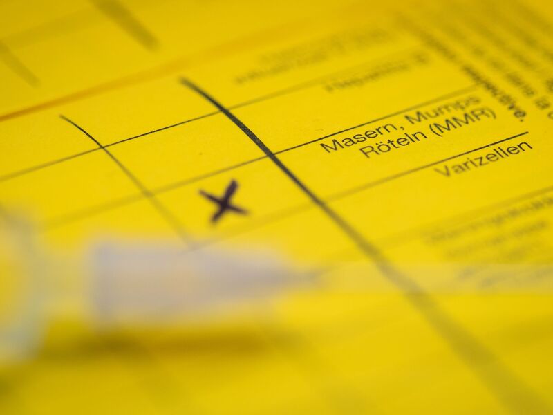 Bei Masern zeigt sich erst oft Fieber, bevor später ein Hautausschlag dazukommt. (Symbolbild) - Foto: Friso Gentsch/dpa