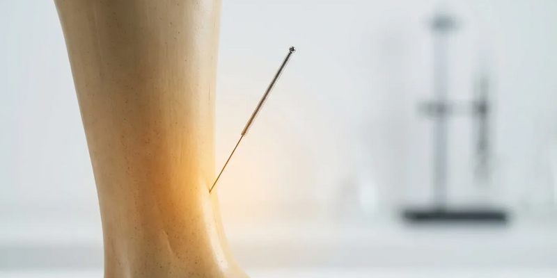 Akupunkturpunkt Milz 6: Neue Studien belegen zentrale Rolle bei Hormonstörungen - Foto: über boerse-global.de