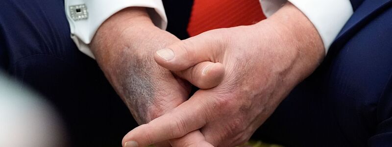 Blaue Flecken geben immer wieder Anlass für Spekulationen. (Archivbild) - Foto: Alex Brandon/AP/dpa