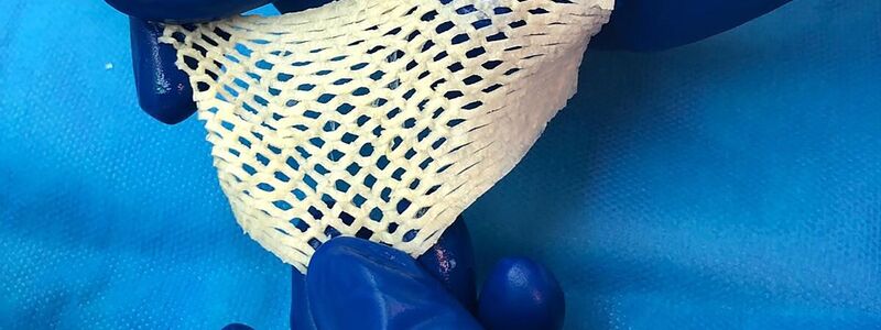 Wichtige Alternative für Hautttansplantationen: Fischhaut. - Foto: Saziye Karaca/-/dpa