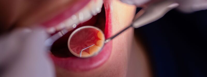 Zahnarztbehandlungen sollen nach dem Willen des CDU-Wirtschaftsrats «nicht länger im Umlageverfahren den Beitragszahlern zur Last fallen». (Symbolbild) - Foto: Rolf Vennenbernd/dpa