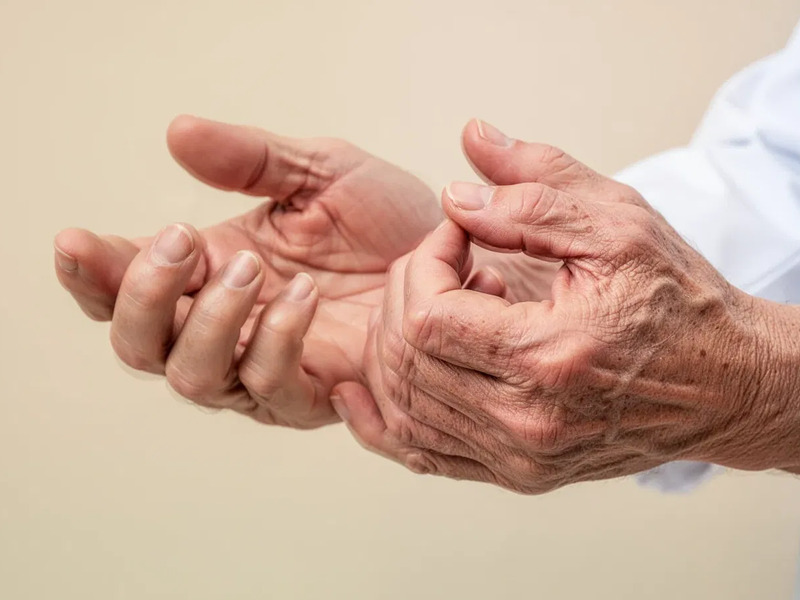 Fingerarthrose: Mit Bewegung und Gelenkschutz gegen den Schmerz - Foto: über boerse-global.de