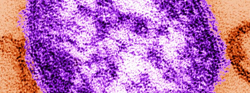 Die Abbildung mit Hilfe eines Transmissionselektronenmikroskops zeigt Teile eines Masernvirus - Foto: Cynthia Goldsmith/Centers for Disease Contról and Prevention/dpa