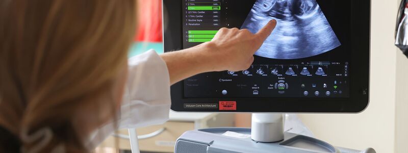 Auf dem Ultraschallbild ist laut der Ärztin zu sehen, dass Jasmin Schmidt wieder Zwillingsmädchen bekommt. - Foto: Daniel Löb/dpa