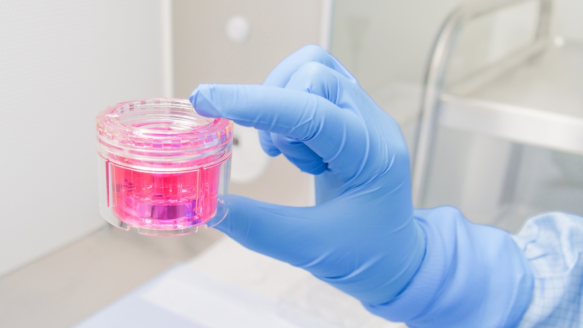 So viele Gewebespenden wie noch nie - eine Gemeinschaftsleistung!