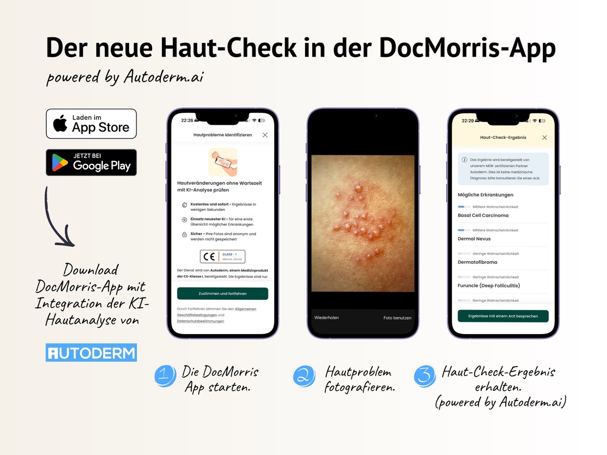 Autoderm ergänzt digitales Gesundheitsökosystem von DocMorris mit KI-Hautanalyse