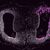 Teil des Axolotl-Vorderhirns zwei Wochen nach einer dorsalen Schnittverletzung in der rechten Hemisphäre. Die Zellen schließen die Verletzungsstelle (magenta). - Foto: Katharina Lust/IMP/dpa